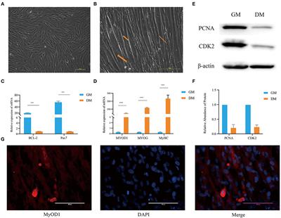 The Expression Profiles of mRNAs and lncRNAs in Buffalo Muscle Stem Cells Driving Myogenic Differentiation